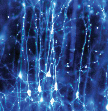 Dr. Jonathan Clarke/Wellcome Images