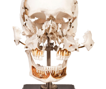 A BONE TO PICK: A Beauchene skull most likely prepared by a French anatomy dealer (mid-nineteenth century). Courtesy of the Warren Anatomical Museum at the Countway Library of Medicine. </br> Photo credit: Paul Morrison