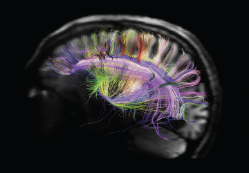 Photo credit: Van Wedeen and Lawrence Wald, Martinos Center for Biomedical Imaging, Massachusetts General Hospital, MGH-UCLA Human Connectome Project