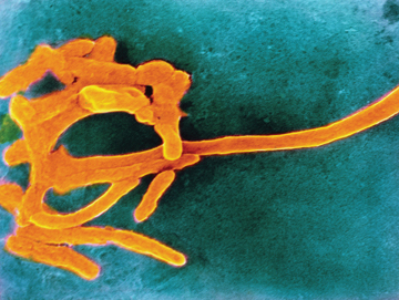 Image by CNRI/Science Photo Library