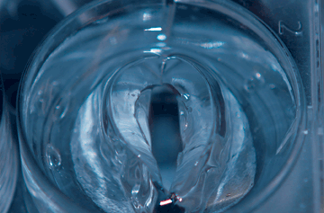 Photo courtesy of MGH Center for Laryngeal Surgery and Voice Rehabilitation