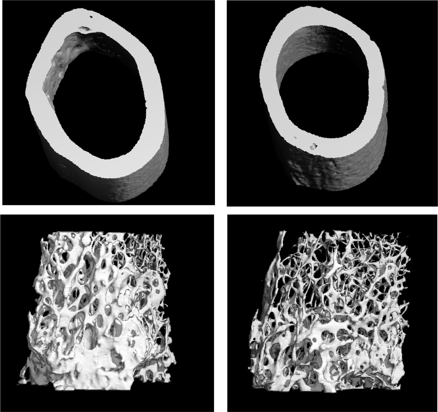 A CT scan of a normal femur (top and bottom left) compared to one without VEGF (top and bottom right). Bone thickness and density is significantly reduced. Image courtesy of Olsen lab.
