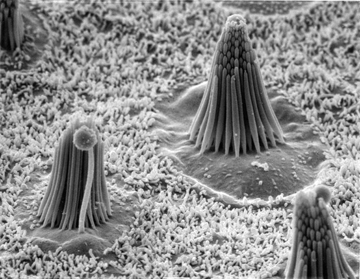 Inner ear hair cells, the very cells that convert a mechanical stimulus like sound or head movement into neural signals. Here you can see the mechanosensitive cilia bundles of three cells; the rest of each cell is below the visible surface. Image courtesy of Corey lab.