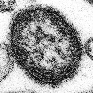 Measles virus. Image from CDC/ Courtesy of Cynthia S. Goldsmith; William Bellini