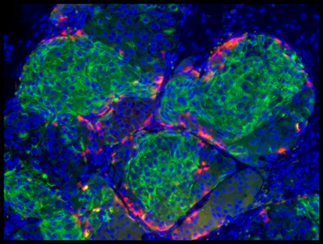 Human stem cell-derived beta cells have formed islet-like clusters in a mouse. Two weeks after transplantation to the kidney they were making insulin, eliminating diabetes in the mouse. Image: Douglas Melton