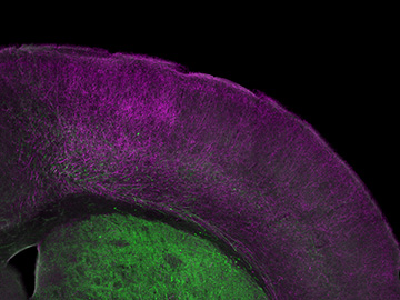Microscopic view of the frontal cortex of a mouse showing the two types of neurons (ChAT+, purple; ChAT-, green) that stem directly from the basal ganglia. Image: Arpiar Saunders and Chip Gerfen