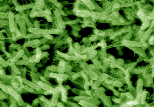 Microscope image shows a mesh of rod-shaped bacteria filling the screen