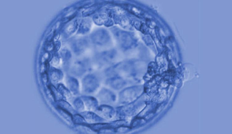 microscope image of a spherical blastocyst--membrane enclosing a few cells that form an early embryo