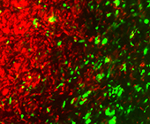 CRISPR engineered therapeutic cancer cells (green) tracking primary cancer cells (red) in the brain.