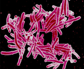 Rod-shaped TB bacteria