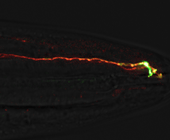 gif showing a normal-size neuron at birth and and an overgrown neuron in adulthood in C. elegans worms