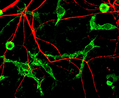 Microglia (green) interacting with neuronal processes (red)