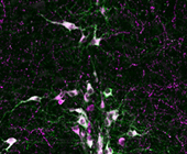 serotonin-producing neurons