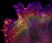 flourescent proteins lighting up cell cytoskeleton