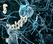 alzheimer's disease