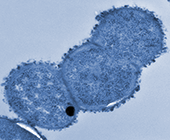 R. gnavus via transmission electron microscopy