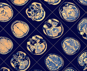 brain scans