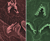 untreated hair cells (left) and treated hair cells (right) of Beethoven mice