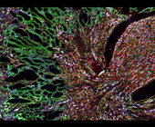 Misfolded MUC1-fs protein build up in mouse kidney