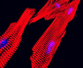 Microscopy image of red striated heart muscle fibers with blue nuclei