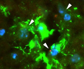 Tumor-derived exosomes (red, arrows) cross the blood-brain barrier and are taken up by astrocytes (green) in mouse brain tissue.
