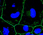Confocal microscopy image of a whole mount of female mouse CE at 3 months post 500 J/cm2 UVA (green: ZO-1 staining (tight membrane junctions); blue: nuclear staining using DAPI)