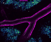Gif showing arteries in a mouse brain dilate in response to local neural activity