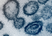 microscopic view of the new coronavirus