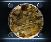 image of bacteria in petri dish