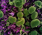 microcopic image of SARS-CoV-2