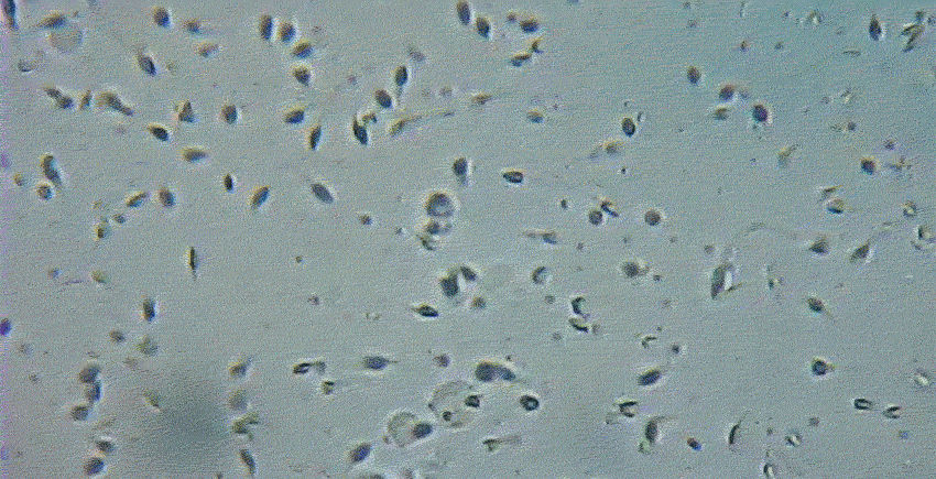 giphy of sperm under microscope