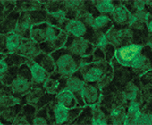 Micrograph with green-stained cells