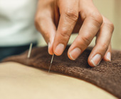 closeup of a hand inserting acupuncture needle into a person's skin
