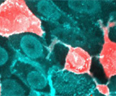 microscope image of cells with SARS-CoV-2 penetration, indicated by pink stain on teal cells