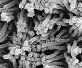 Black and white microscope image shows dozens or hundreds of tube-like projections aligned in different directions