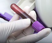 Photo of blood vial in gloved hand