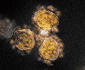 image of SARS-CoV-2