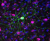 Colorized micrograph shows web of green tendrils emanating from a nucleus against a backdrop of puple nuclei on black