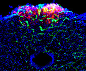 glp neurons