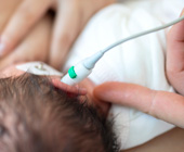 photo of infant getting hearing test
