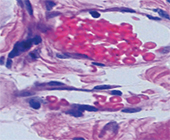 Micrographs of swirls of pink and purple stained cells on a gray background.