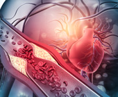 digital image of heart and blocked arterty