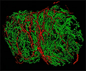 Digital image of a lymph node