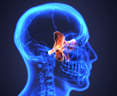 digital x-ray image of sinuses