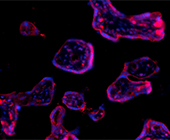 Micrograph showing cells lit in purple against a black background