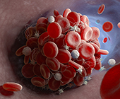 digital image of blood clot