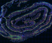 p53 protein levels (green) in the small intestine after irradiation