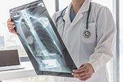 Physician holding chest x-ray film