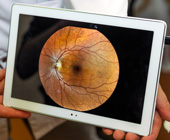 hands holding an iPad with an image of ocular fundus