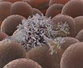 digital illustration of a cancer cell spreading among healthy cells